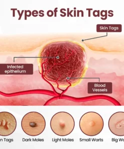 Rekulo® KeraErase Dual-Action Renewal Cream