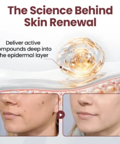 Rekulo® KeraErase Dual-Action Renewal Cream