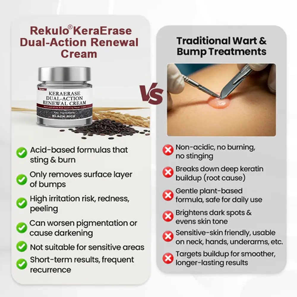 Rekulo® KeraErase Dual-Action Renewal Cream