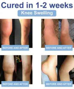 Rekulo® Magnesium Pain Healing Bone Cream