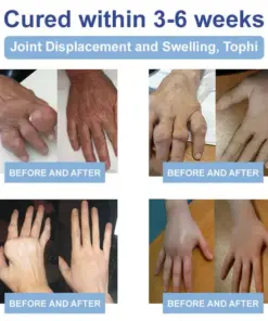 Rekulo® Magnesium Pain Healing Bone Cream