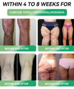 Rekulo® Zepbound Oral Solution