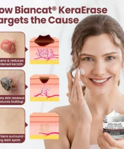 Rekulo®KeraErase Dual-Action Renewal Cream