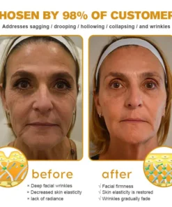 Rekulo™ Botox Bee Venom Wrinkle Removal Cream