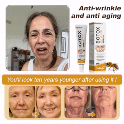 Rekulo™ Botox Bee Venom Wrinkle Removal Cream