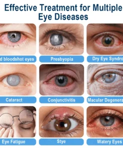Rekulo® OptiMist Eye Spray